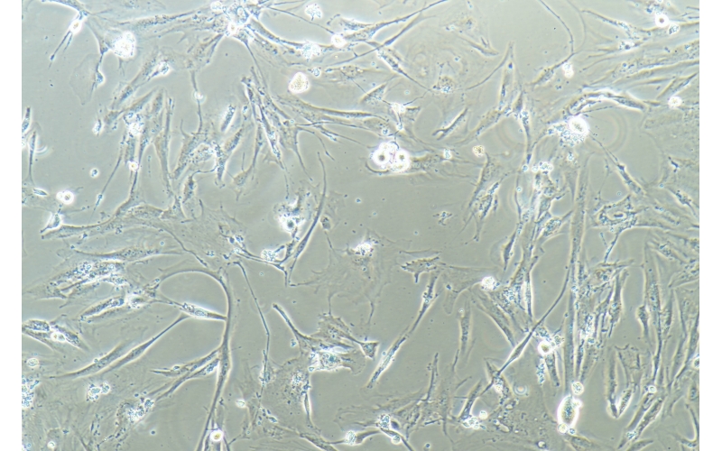 CELL-C0525 hEM15A 人子宮異位內膜上皮細胞永生化細胞系
