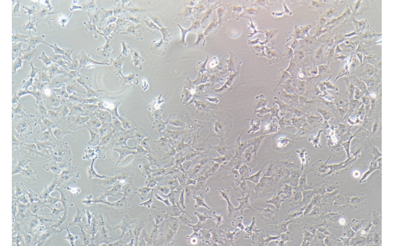 CELL-C0114 Hs?578T人乳腺癌細胞