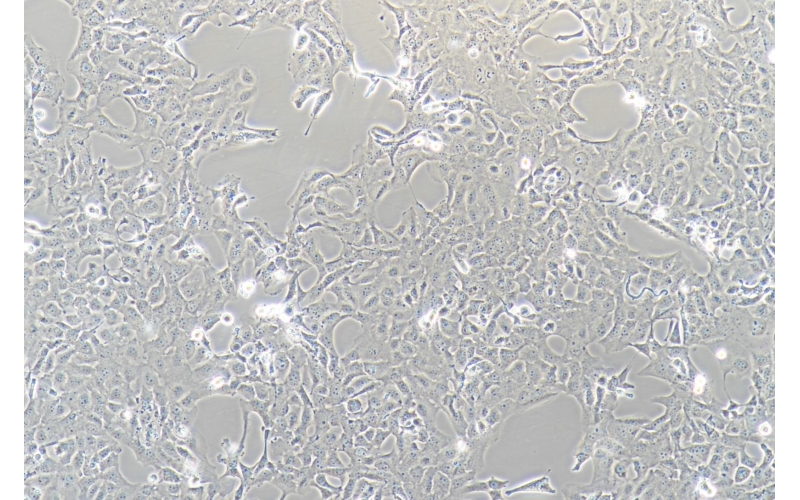 CELL-C0537 B-CPAP人甲狀腺癌細胞