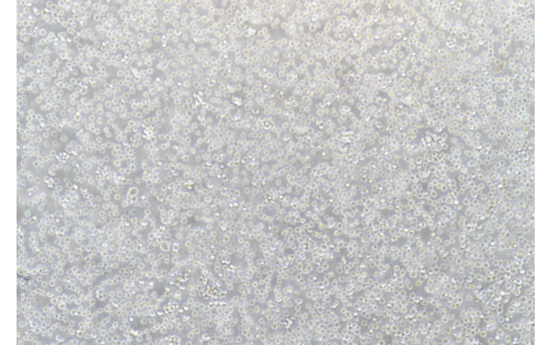CELL-C0189 Raji人Burkitt