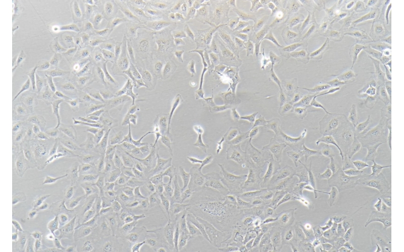 CELL-C0215 SK-OV-3人卵巢癌細胞