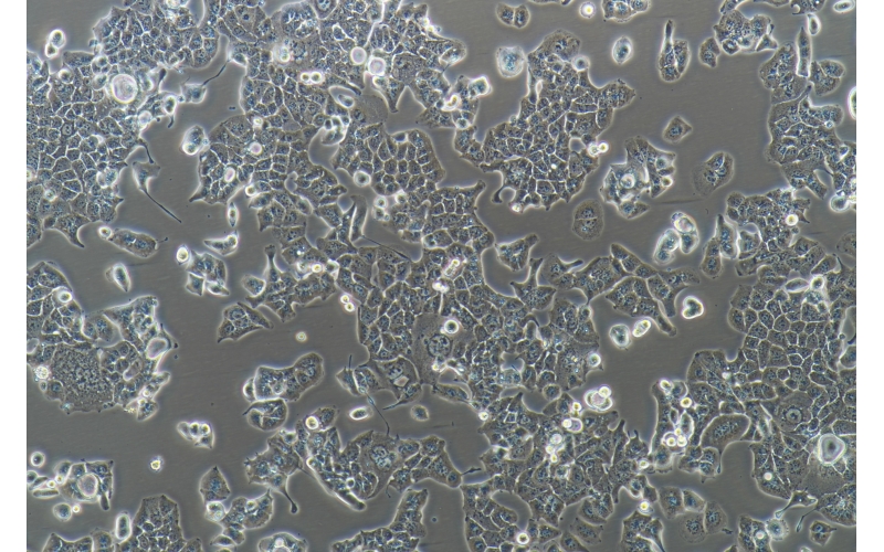 CELL-C0100 HEC-1-B人子宮內膜腺癌細胞